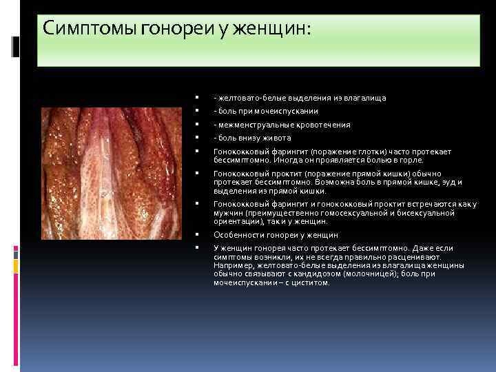 Симптомы гонореи у женщин: - желтовато-белые выделения из влагалища - боль при мочеиспускании -