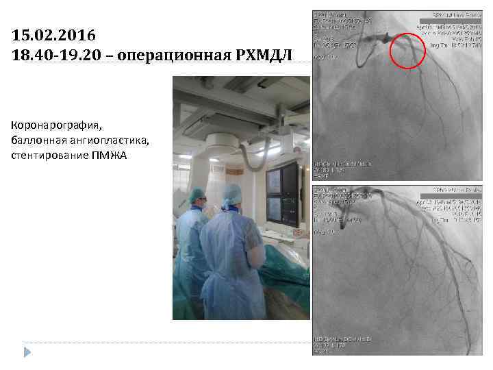 15. 02. 2016 18. 40 -19. 20 – операционная РХМДЛ Коронарография, баллонная ангиопластика, стентирование