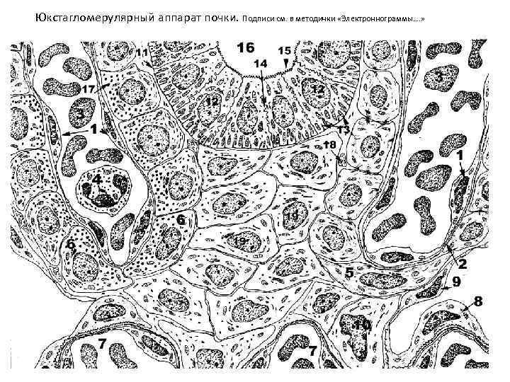 Юкстагломерулярный аппарат почки. Подписи см. в методички «Электроннограммы…. » 