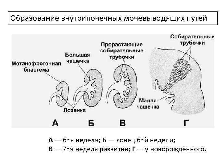 Образование внутрипочечных мочевыводящих путей А — 6‑я неделя; Б — конец 6‑й недели; В