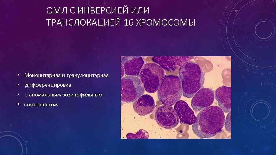 ОМЛ С ИНВЕРСИЕЙ ИЛИ ТРАНСЛОКАЦИЕЙ 16 ХРОМОСОМЫ • Моноцитарная и гранулоцитарная • дифференцировка •