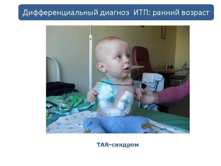 Дифференциальный диагноз ИТП: ранний возраст TAR-синдром 
