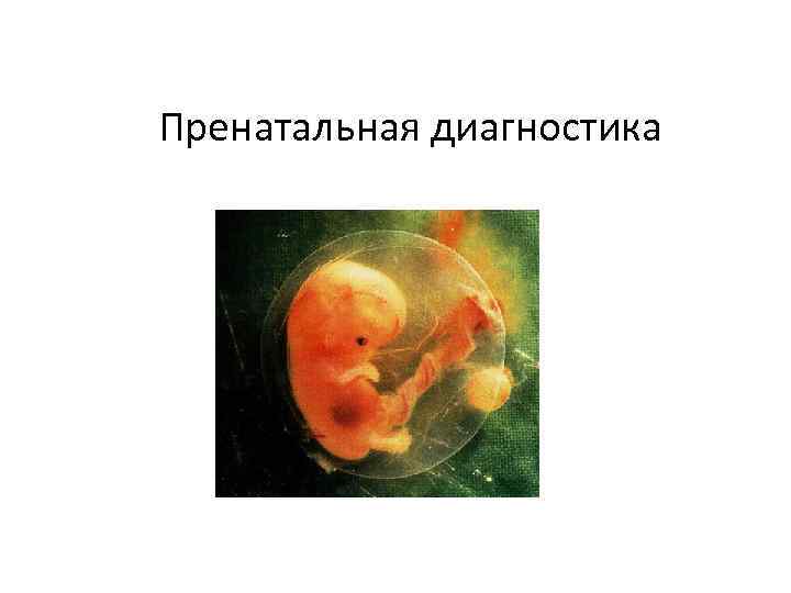  Пренатальная диагностика 