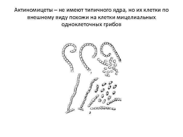Актиномицеты – не имеют типичного ядра, но их клетки по внешнему виду похожи на