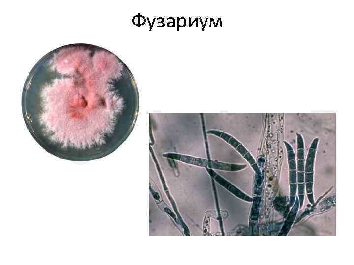 Фузариум 