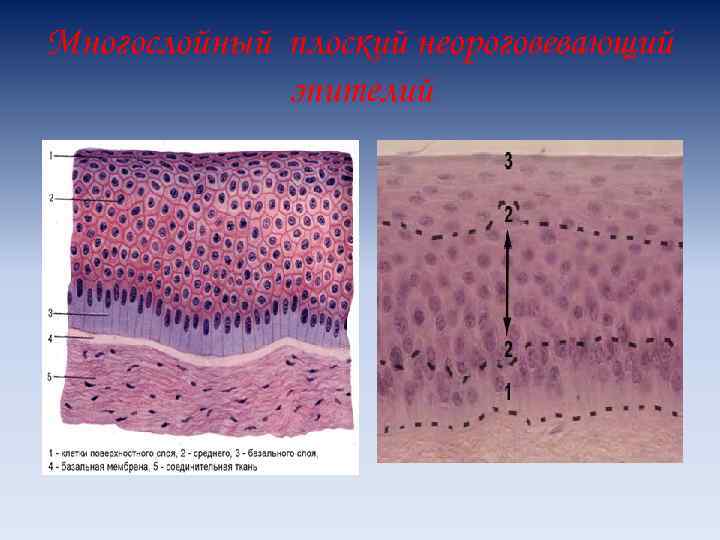 Многослойный плоский неороговевающий эпителий 