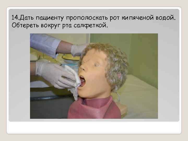 14. Дать пациенту прополоскать рот кипяченой водой. Обтереть вокруг рта салфеткой. 