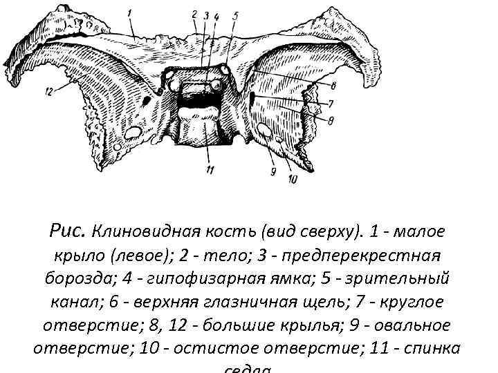 Рис. Клиновидная кость (вид сверху). 1 - малое крыло (левое); 2 - тело; 3