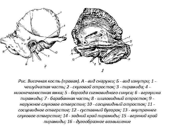 Рис. Височная кость (правая). А - вид снаружи; Б - вид изнутри; 1 чешуйчатая