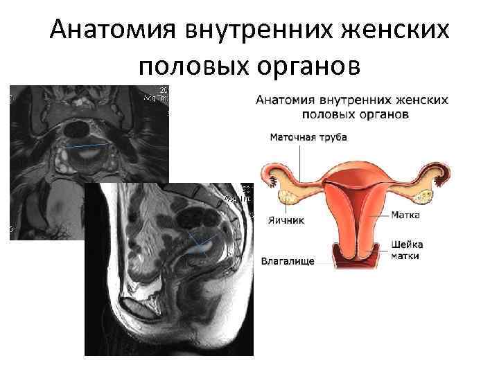 Рисунок женского органа