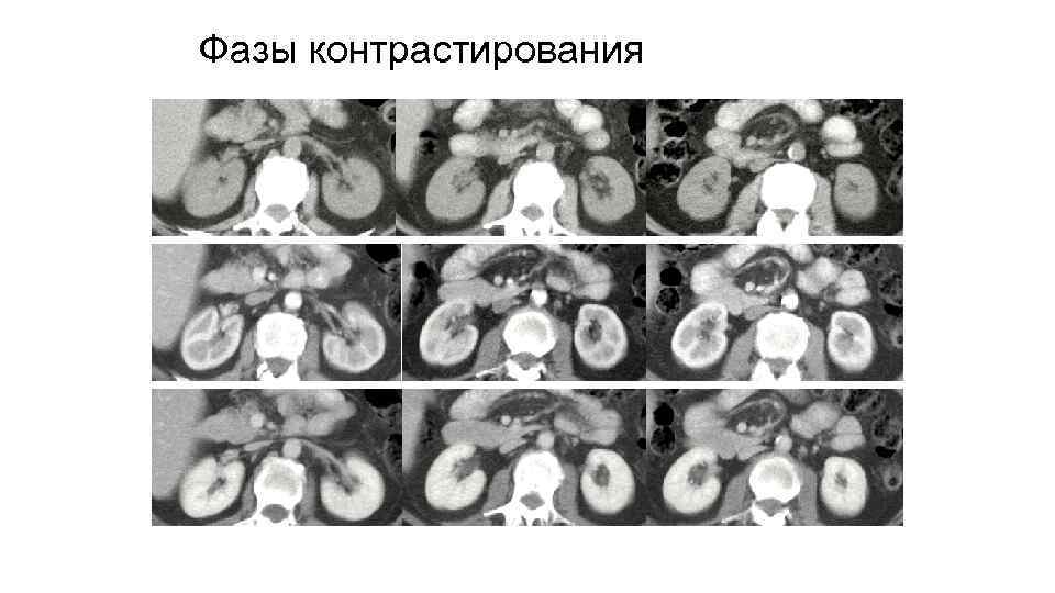 Фазы контрастирования 