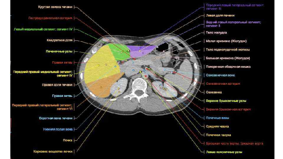 Сегменты печени на кт схема