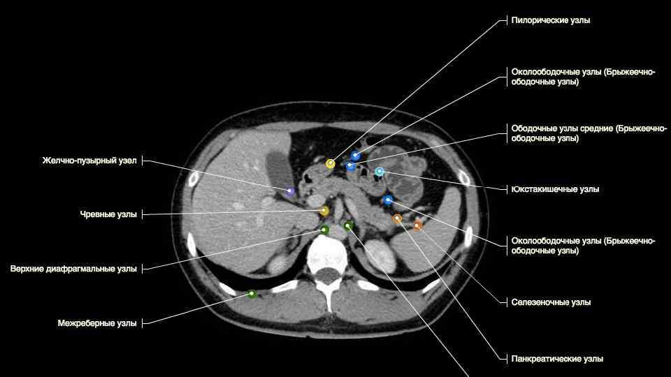 Органы брюшной полости у мужчин расположение в картинках