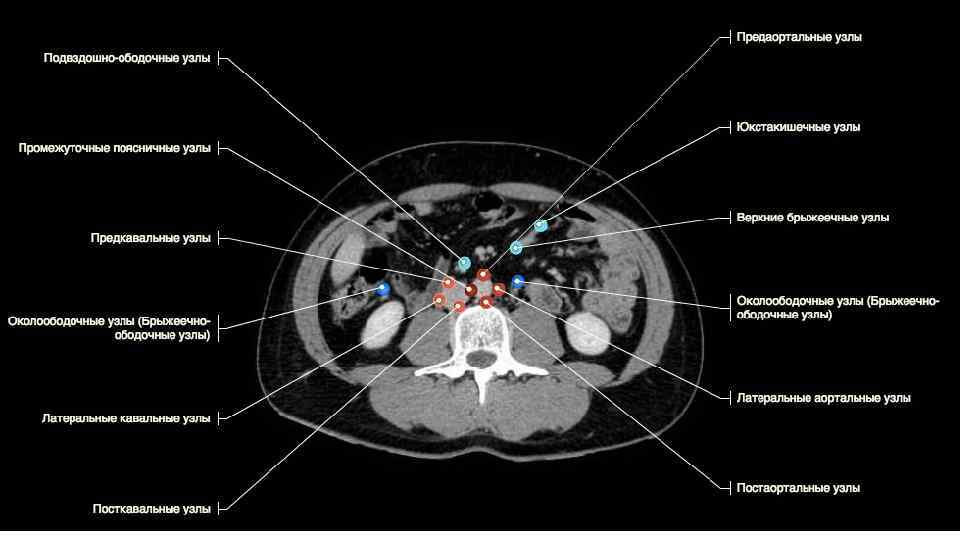 Лимфоузлы брюшной полости схема