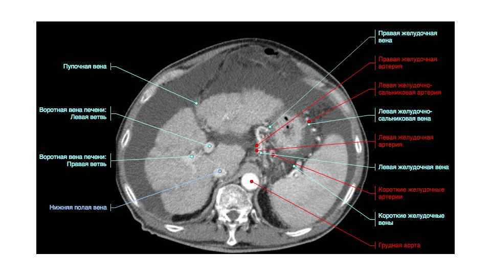 Анатомия внутренних органов человека брюшной полости в картинках