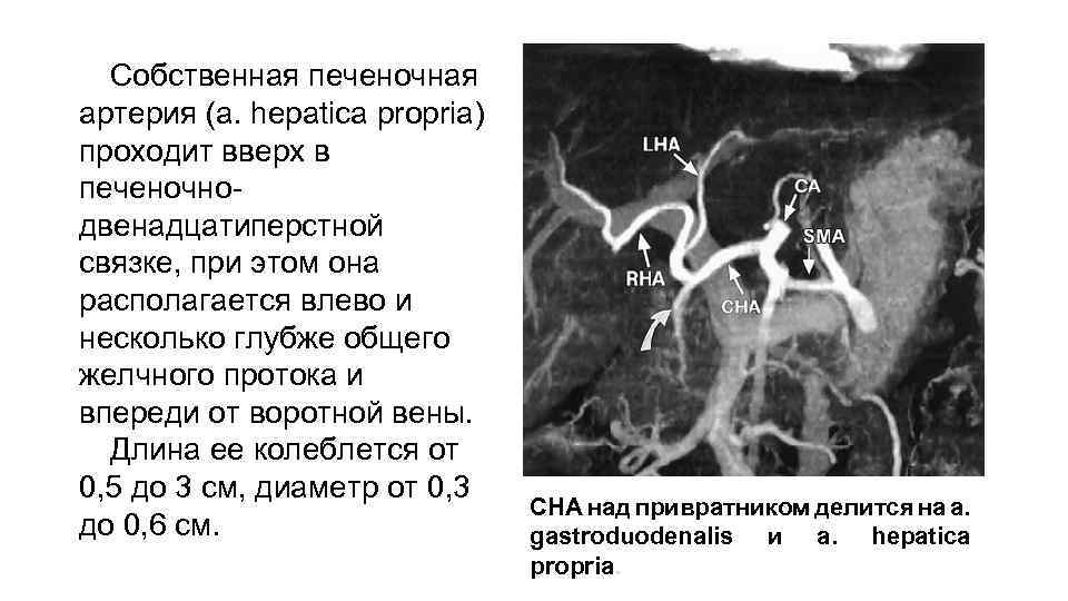 Собственная печеночная артерия (а. hepatica propria) проходит вверх в печеночнодвенадцатиперстной связке, при этом она