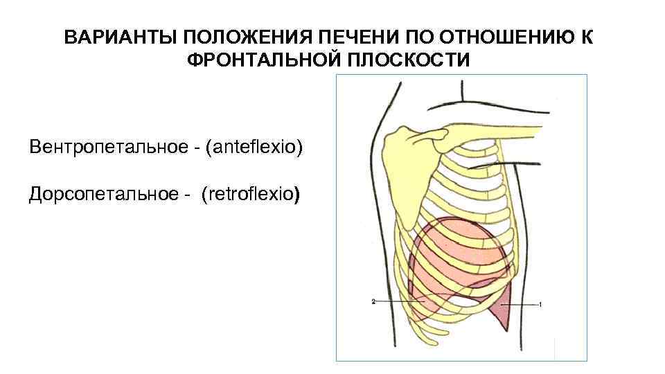 ВАРИАНТЫ ПОЛОЖЕНИЯ ПЕЧЕНИ ПО ОТНОШЕНИЮ К ФРОНТАЛЬНОЙ ПЛОСКОСТИ Вентропетальное - (anteflexio) Дорсопетальное - (retroflexio)