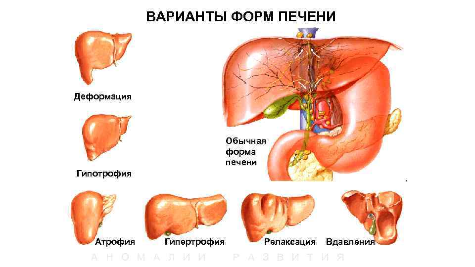  ВАРИАНТЫ ФОРМ ПЕЧЕНИ Деформация Обычная форма печени Гипотрофия Атрофия Гипертрофия Релаксация Вдавления А