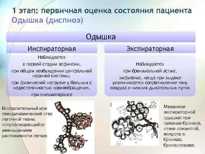 1 этап: первичная оценка состояния пациента Одышка (диспноэ) Одышка Инспираторная Экспираторная Наблюдается в первой