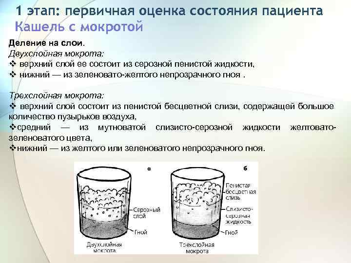 1 этап: первичная оценка состояния пациента Кашель с мокротой Деление на слои. Двухслойная мокрота: