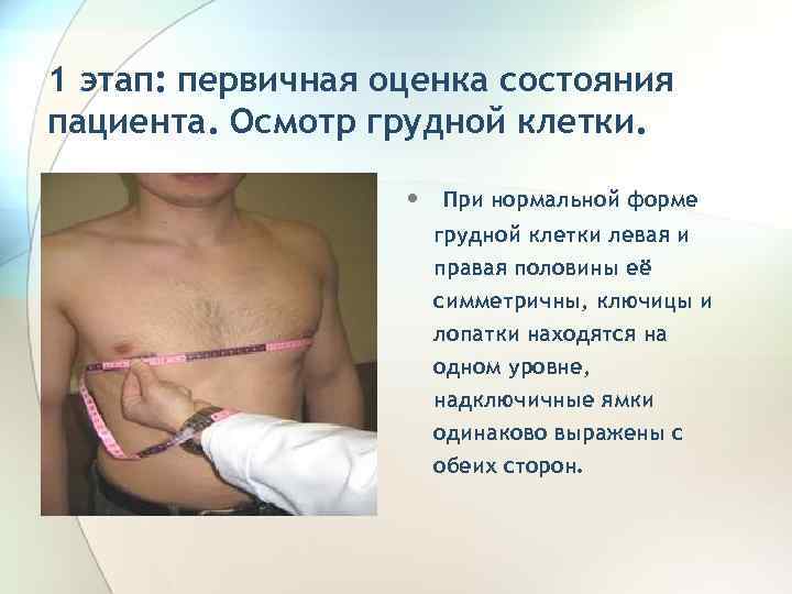 1 этап: первичная оценка состояния пациента. Осмотр грудной клетки. • При нормальной форме грудной