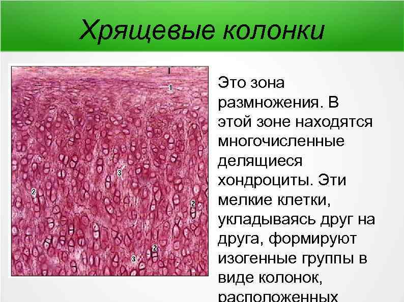 Хрящевые колонки Это зона размножения. В этой зоне находятся многочисленные делящиеся хондроциты. Эти мелкие