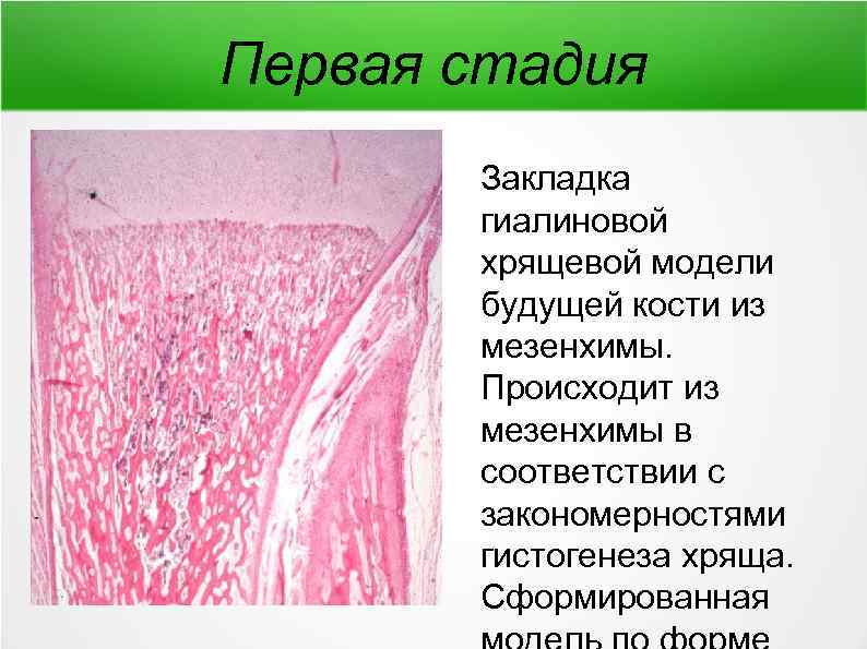 Схема непрямого остеогенеза гистология