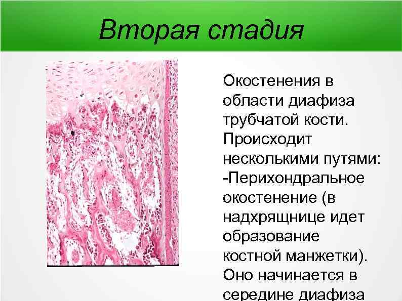 Схема непрямого остеогенеза гистология