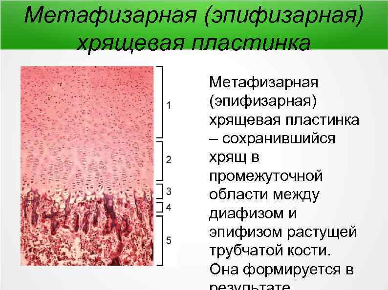 Непрямой остеогенез