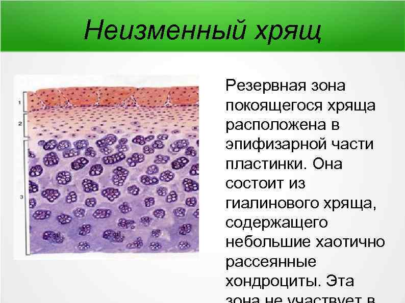 Эпифизарный хрящ. Минерализованный гиалиновый хрящ. Метаэпифизарная хрящевая пластинка препарат. Эпифизарная пластинка хряща гистология. Метаэпифизарная хрящевая пластинка гистология.