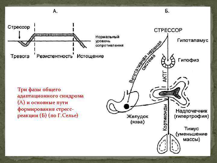 Три фазы общего адаптационного синдрома (А) и основные пути формирования стрессреакции (Б) (по Г.