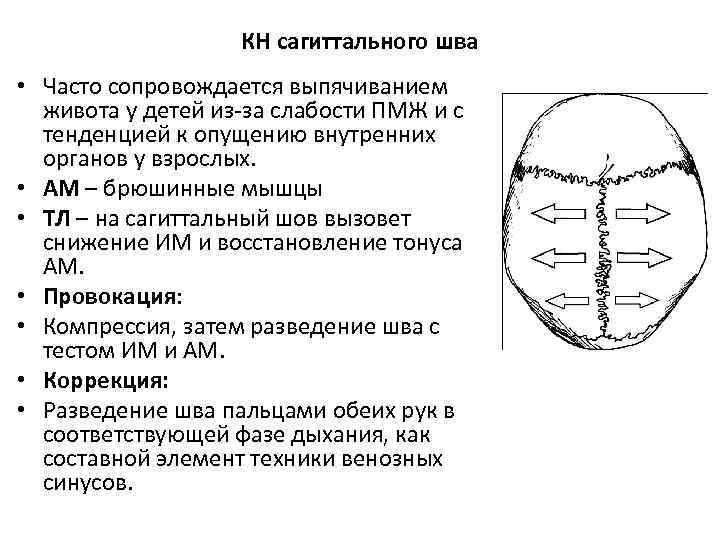 КН сагиттального шва • Часто сопровождается выпячиванием живота у детей из-за слабости ПМЖ и