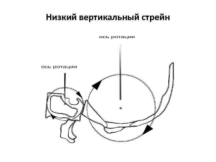 Низкий вертикальный стрейн 