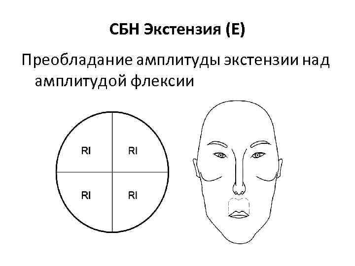 СБН Экстензия (Е) Преобладание амплитуды экстензии над амплитудой флексии 