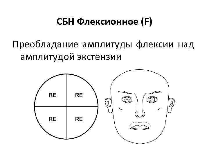 СБН Флексионное (F) Преобладание амплитуды флексии над амплитудой экстензии 