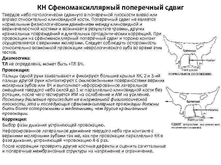 КН Сфеномаксиллярный поперечный сдвиг Твердое небо патологически сдвинуто в поперечной плоскости влево или вправо