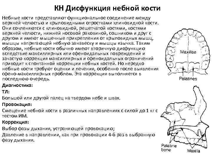 КН Дисфункция небной кости Небные кости представляют функциональное соединение между верхней челюстью и крыловидными