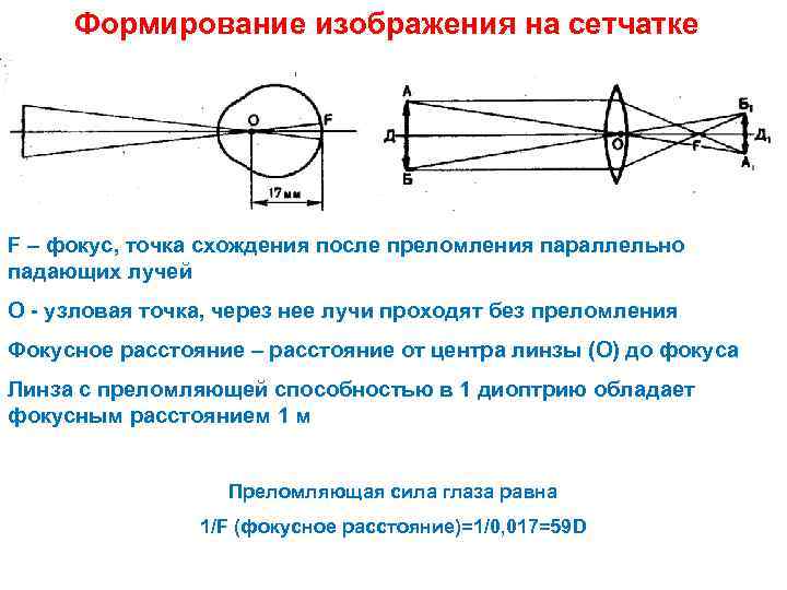 В здоровом глазу в результате преломления изображение формируется на