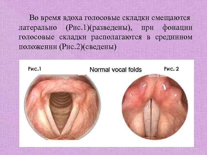 Во время вдоха голосовые складки смещаются латерально (Рис. 1)(разведены), при фонации голосовые складки располагаются