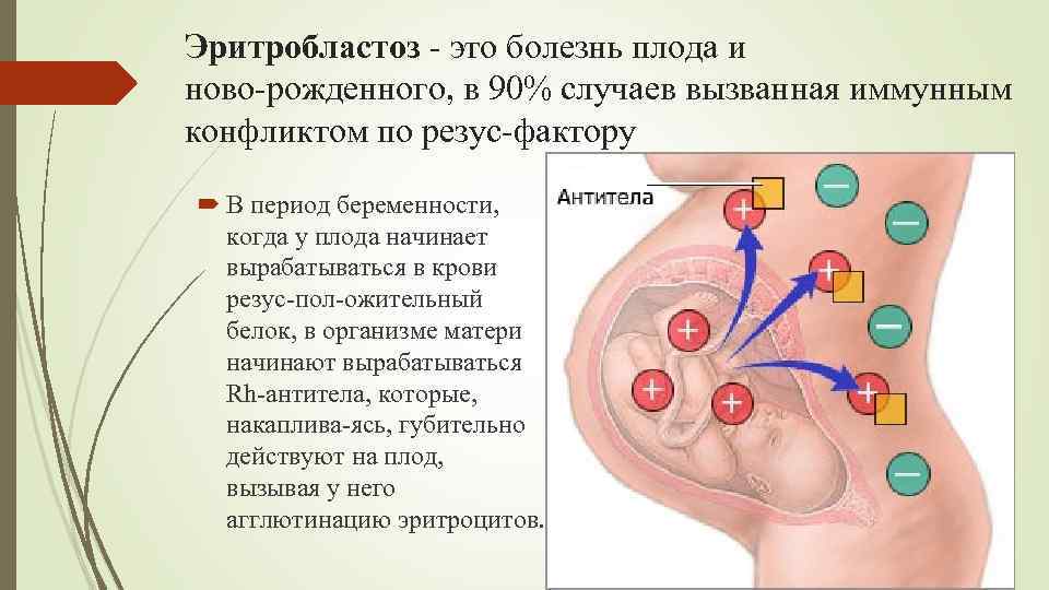 Эритробластоз это болезнь плода и ново рожденного, в 90% случаев вызванная иммунным конфликтом по