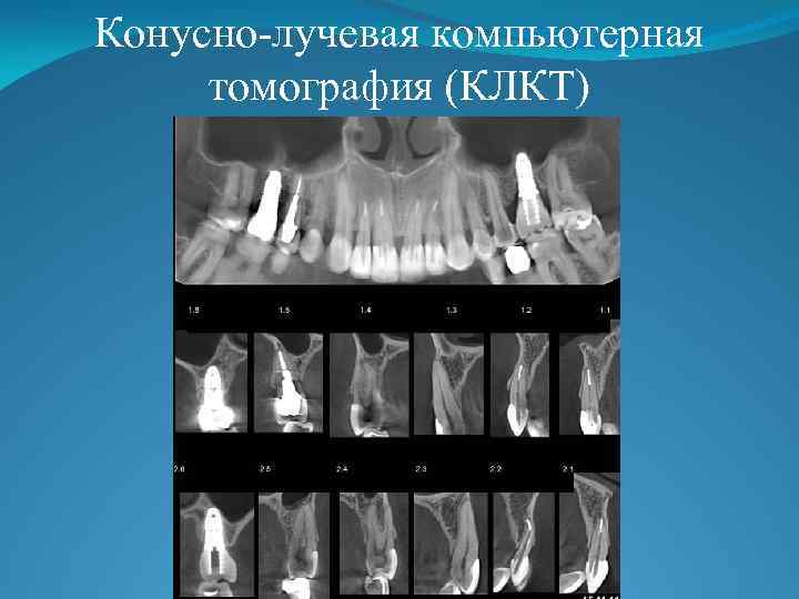 Лучевая диагностика в стоматологии