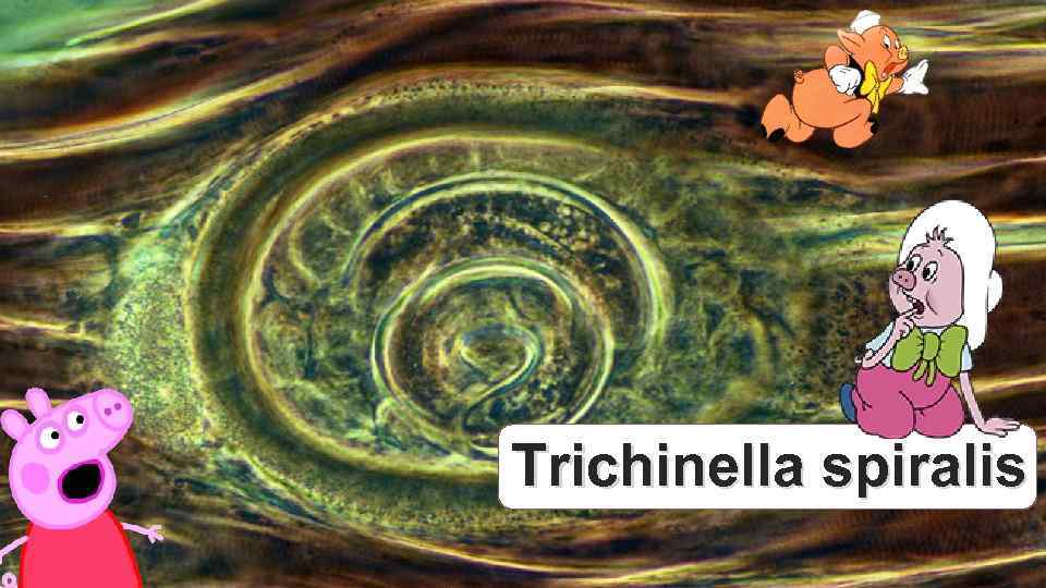 Trichinella spiralis 