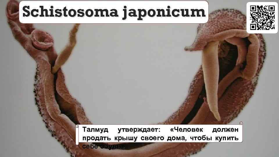 Schistosoma japonicum Талмуд утверждает: «Человек должен продать крышу своего дома, чтобы купить себе обувь»