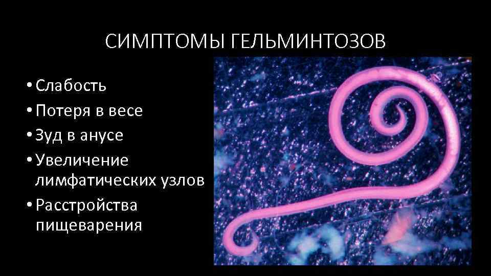 СИМПТОМЫ ГЕЛЬМИНТОЗОВ • Слабость • Потеря в весе • Зуд в анусе • Увеличение