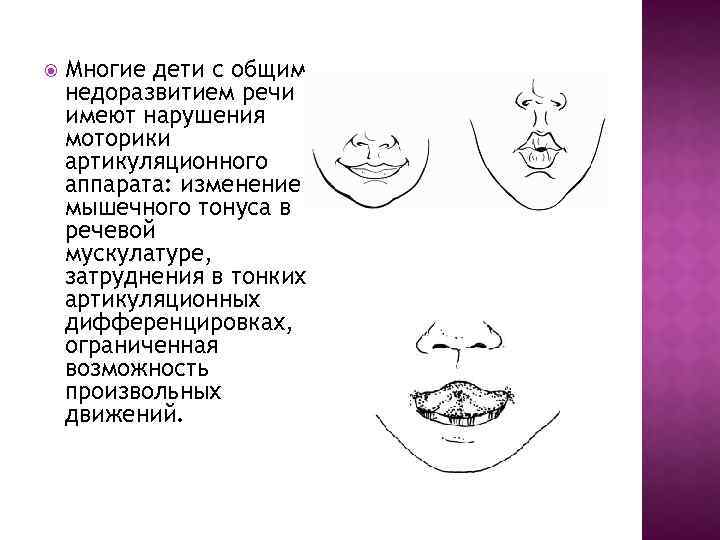 Развитие артикуляционной моторики у детей с нарушением речи презентация