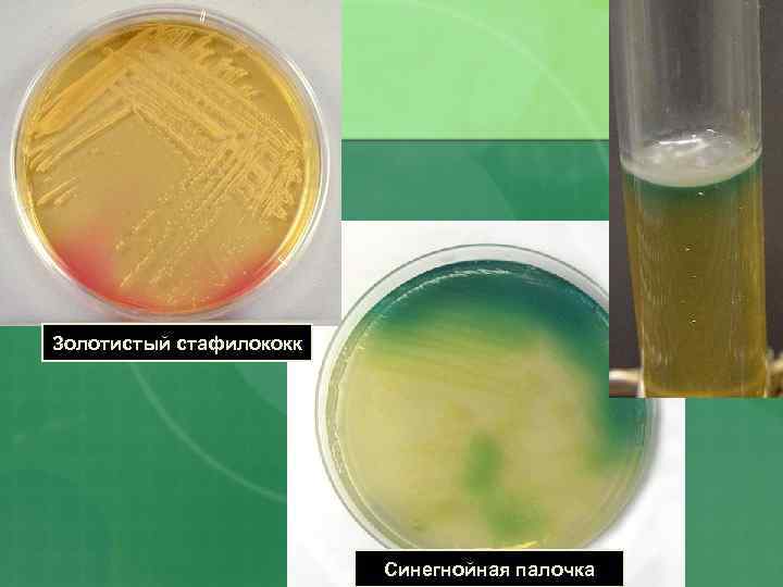 Золотистый стафилококк Синегнойная палочка 