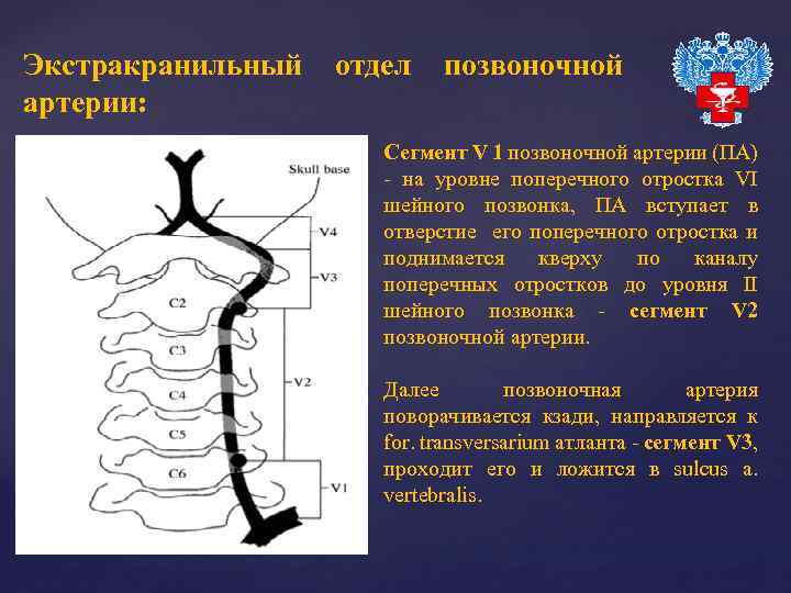 Экстракранильный артерии: отдел позвоночной Сегмент V 1 позвоночной артерии (ПА) - на уровне поперечного