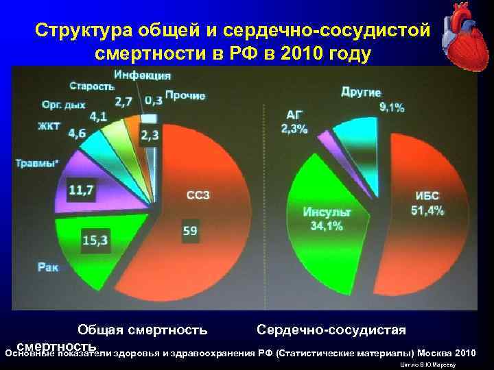 Структура общей и сердечно-сосудистой смертности в РФ в 2010 году Общая смертность Сердечно-сосудистая смертность