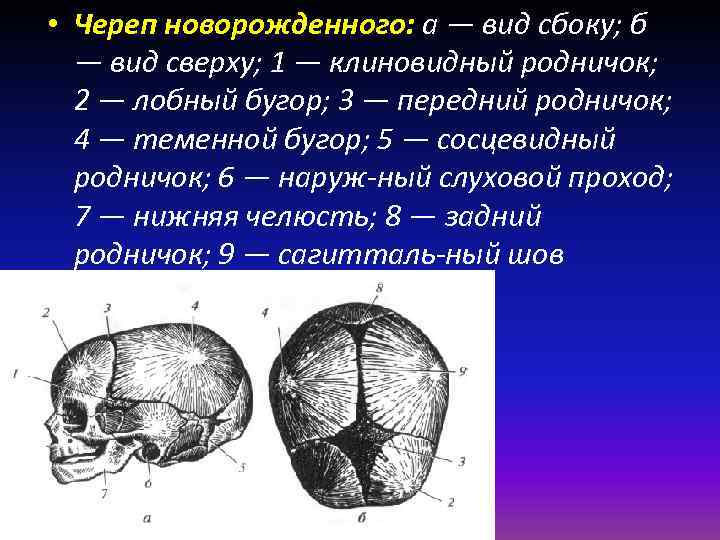 Череп новорожденного. Череп новорожденного вид сбоку и сверху. Череп новорожденного вид сверху. Череп новорожденного вид сбоку вид сверху. Бугры черепа новорожденного.