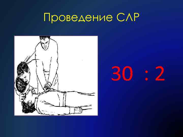 Проведение СЛР 30 : 2 